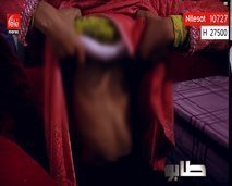 مؤثر : "كفاش نقدر نتعرى قدام راجلي و أنا ماعندي حتى ثدي بحل شي راجل"