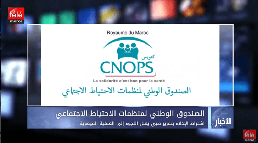 CNOPS : اشتراط الإدلاء بتقرير طبي يعلل اللجوء إلى العملية القيصرية