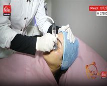 علاج تكميلي بعد إجراء عملية الحقن التجميلي