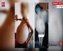 مساحة ضوء : الأمراض النادرة، خطر مجهول يفتك بأرواح أولادنا