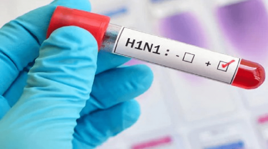 إنفلونزا الخنازير تحصد أرواح 9 أشخاص والدفعة الأولى من مضادات الفيروس تصل المغرب