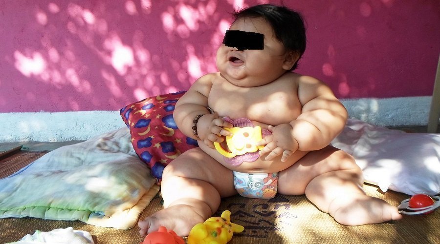 سوء التغذية والسمنة يتهددان حياة الأطفال المغاربة
