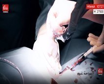 مساحة ضوء: أناس دخلوا غرفة العمليات لإجراء عمليات عادية ليتفاجؤوا بعدها ببثر أعضائهم دون علمهم