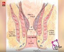 الصحة : أعراض البواسير الأسباب والعلاجات