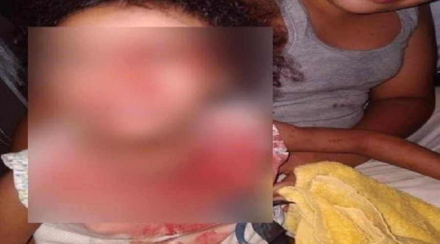 ولاية أمن الرباط تكشف حقيقة صور لطفلة تعرضت لاعتداء شنيع