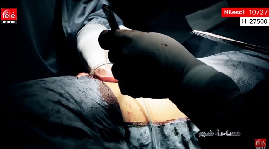 حلقة مثيرة من برنامج "مساحة ضوء" ..حول موضوع : زراعة الأعضاء البشرية بين التبرع و السرقة